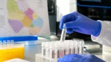Dijon : un dépistage génomique étendu à 19 000 nouveau-nés pour détecter des maladies rares