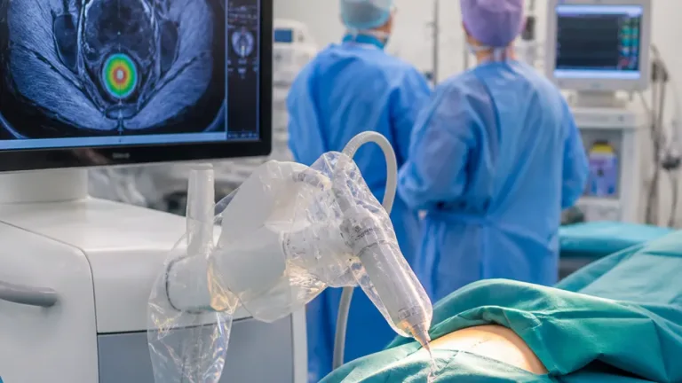 Toulouse : une technique par ultrasons focalisés pour traiter l’endométriose digestive arrive au CHU